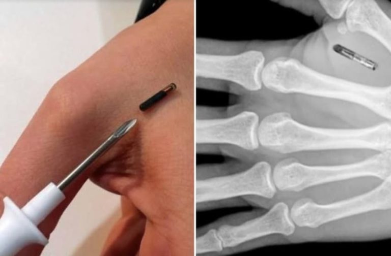 El coronavirus está sirviendo como excusa para implantar un microchip en cada persona